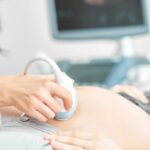ARSA được xác định trên siêu âm thai như thế nào?