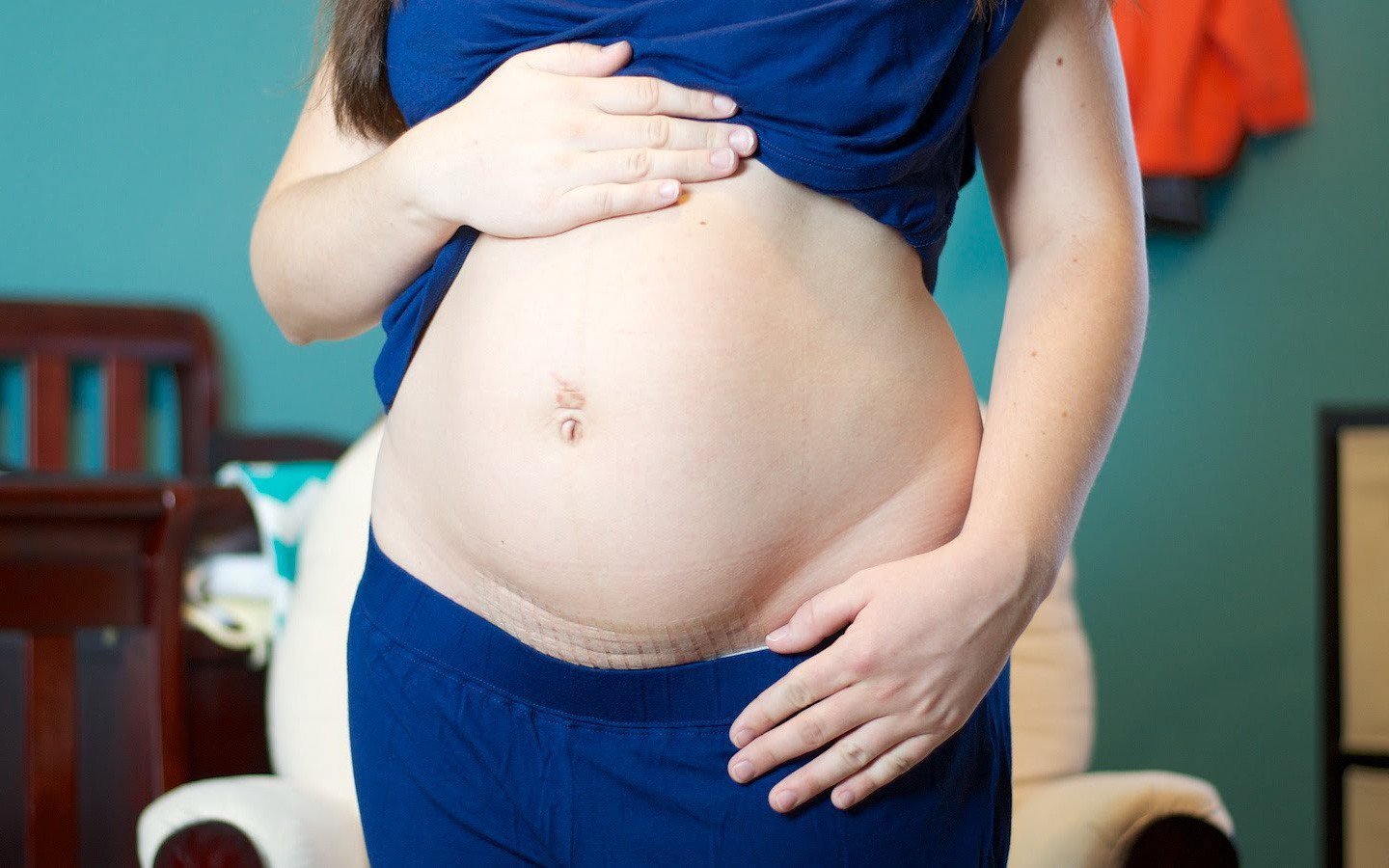 Sinh mổ lần 4: Có thể sinh mổ ở tuần thai nào?