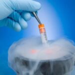 Quy trình chuyển phôi đông lạnh khi làm IVF