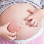 Ngứa nhiều khi mang thai có sao không?