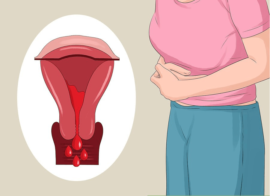 10 câu cần hỏi bác sĩ về lạc nội mạc tử cung