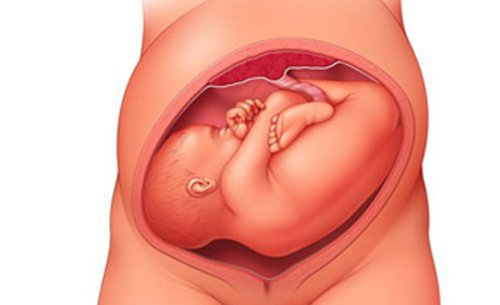 Ngôi thai ngang: Những điều cần biết
