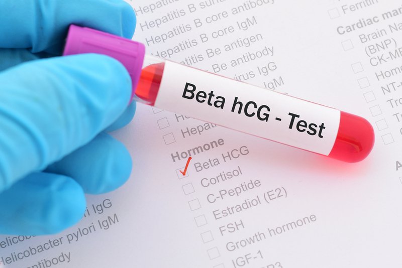 Xét nghiệm beta HCG giá trị bình thường 